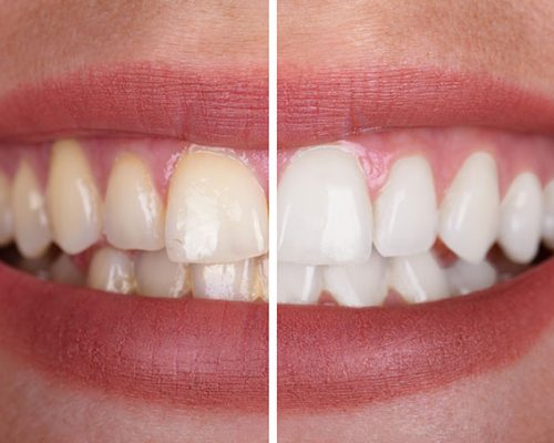 odontologia-estetica